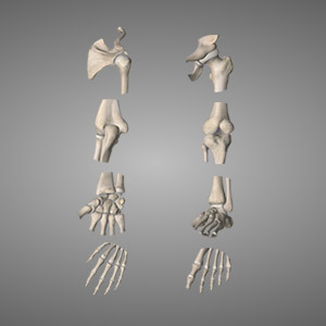 spezialisten fur erosive arthrose munich Prof. Dr. Arsen Babayan