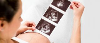 Frau schwanger mit Ultraschallbild vom Baby